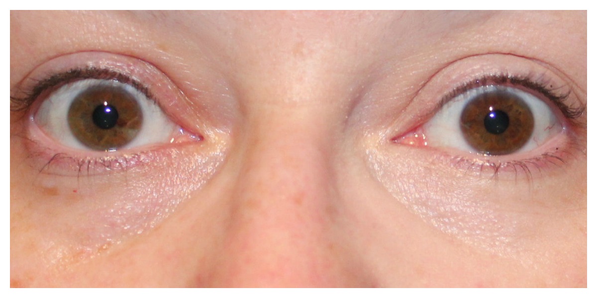 Lacura concealer pen review great for older skin! Love Leah