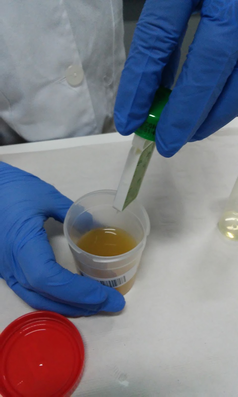 Microbiología UROCULTIVO