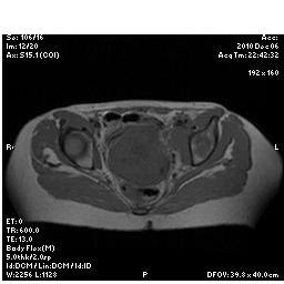 La osteocondrosis de pecho los departamentos de la columna vertebral los síntomas y el tratamiento