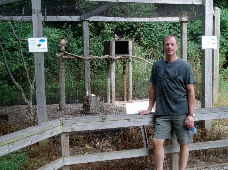 Bird Headed Dwarfism