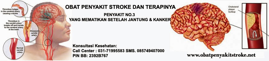 PENYAKIT STROKE | OBAT PENYAKIT STROKE | TERAPI PENYAKIT STROKE | OBAT ALAMI UNTUK PENYAKIT STROKE