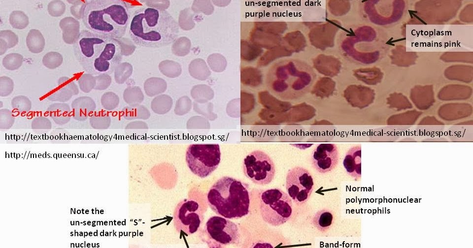 Haematology in a NutShell BandForm Neutrophils