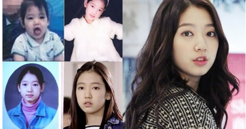 Park Shin Hye plastic surgery before and after pictures - About Korean