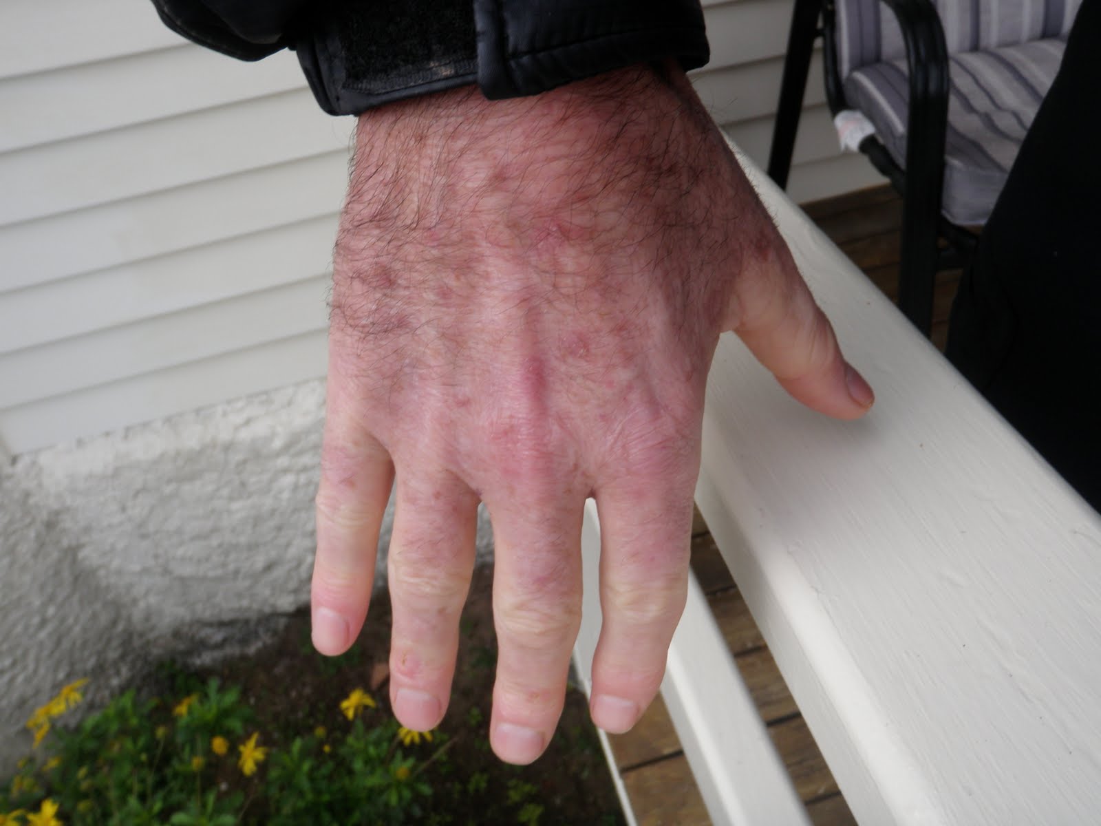 Health, Fitness Naturally! Why do your hands go