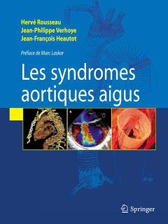Syndromes aortiques aigus - Springer Syndromes aortiques aigus - Springer