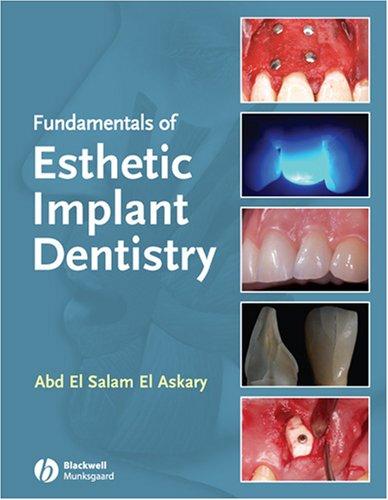 Fundamentals of Esthetic Dentistry, Second Edition 
