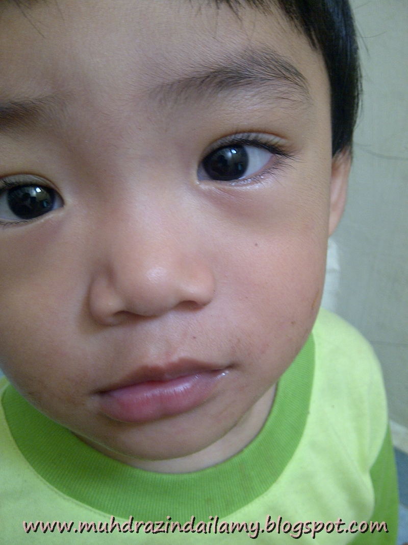Taik Lalat