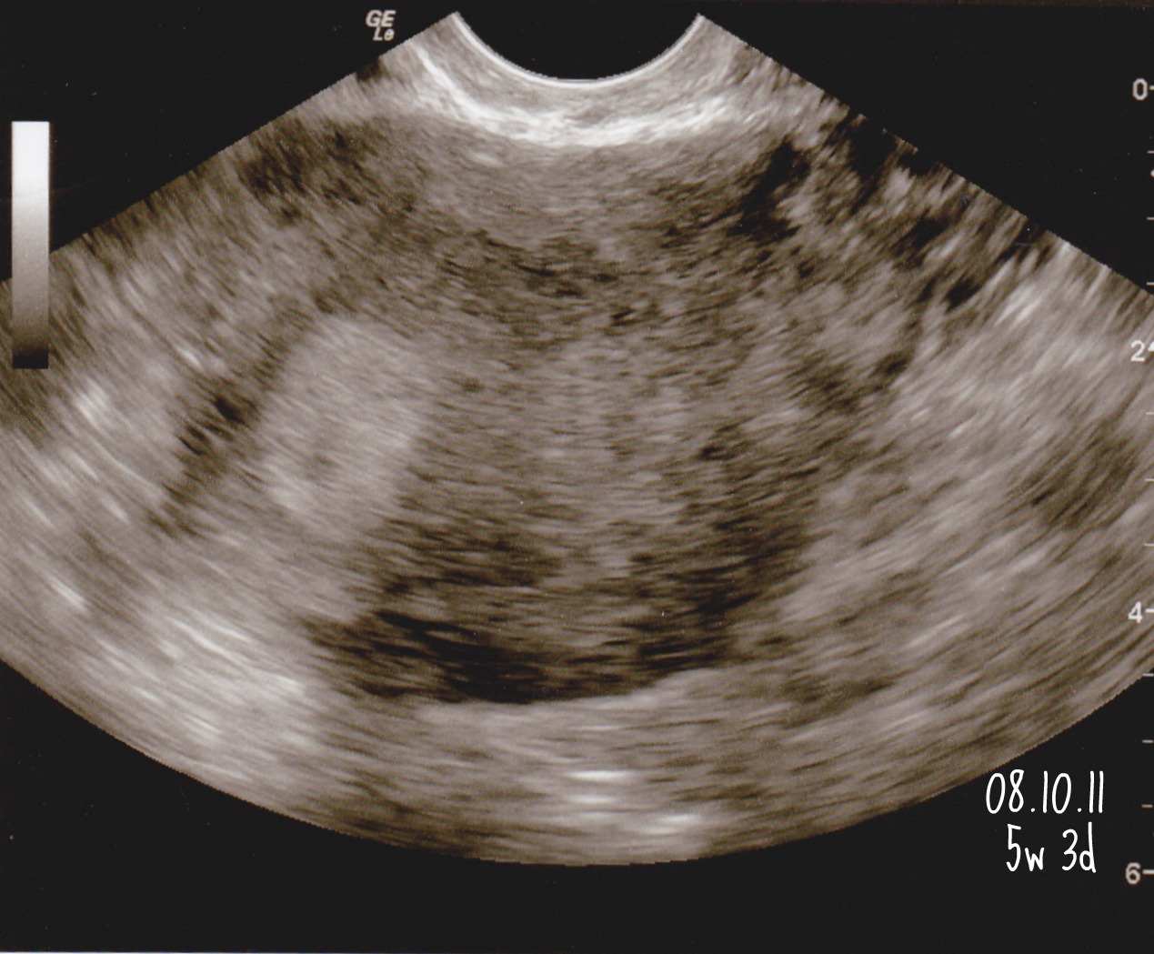 6 week 4d ultrasound pictures 6 week 4d ultrasound pictures