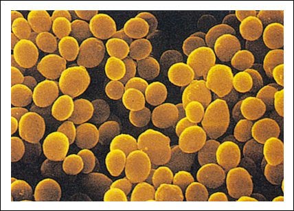 GENERO BACTERIAS genero bacterias: