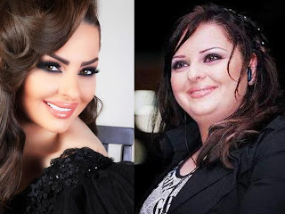 صور الفنانات قبل وبعد عمليات التجميل صور الفنانات قبل وبعد عمليات التجميل