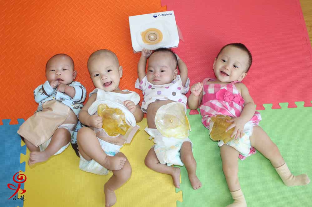 Little Flower Projects Colostomy Cuties Colostomy Cuties