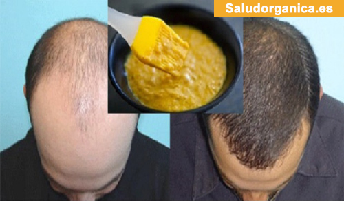 Si el cabello cae con la raíz