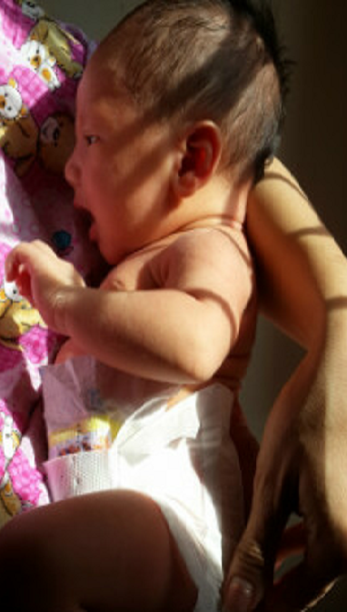 bayi kuning penyebab bayi kuning