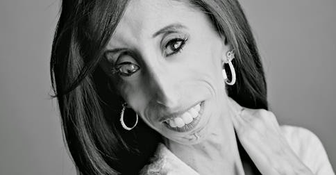 Lizzie Velasquez