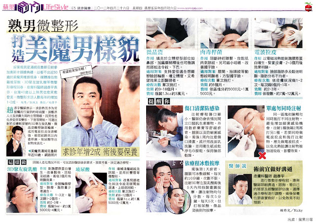 Sculptra, PLLA, 聚左旋乳酸, 聚左乳酸, 舒顏萃, 塑然雅, 男性整形 Sculptra, PLLA, 聚左旋乳酸, 聚左乳酸, 舒顏萃, 塑然雅, 男性整形