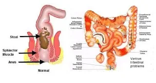 Anatomi saluran pencernaan