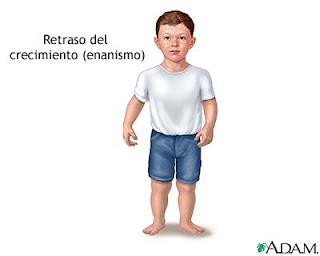 estatura