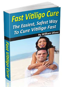 Fast Vitiligo Cure (Recommended)