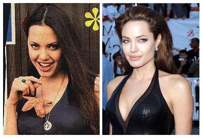 Angelina Jolie Plastic Surgery Before And After