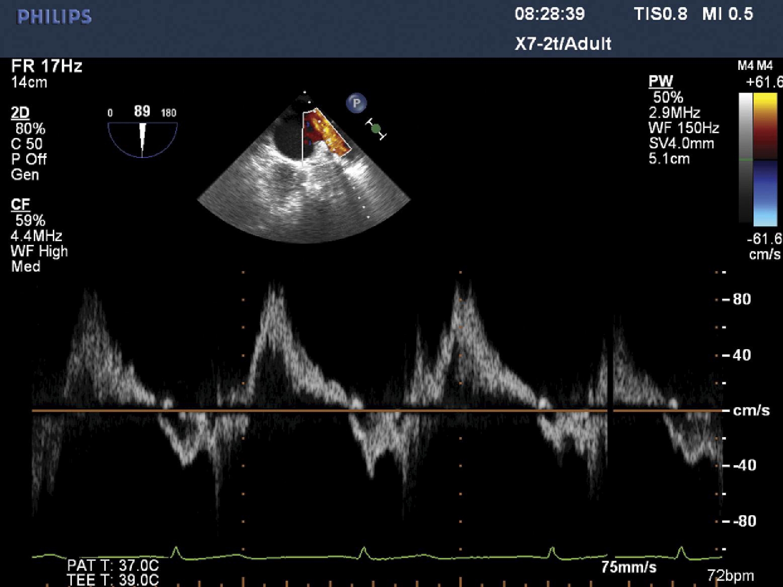 Journal of Cardiothoracic and Vascular Anesthesia Blog July 2012