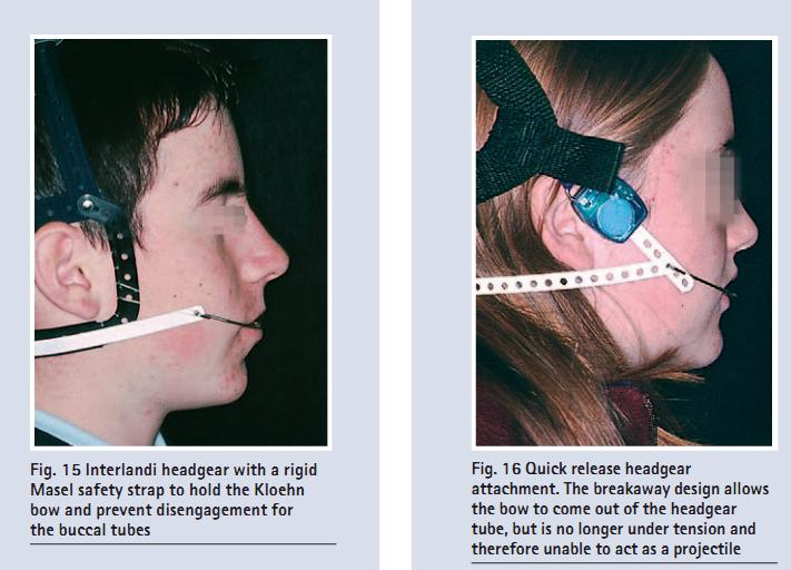 Dentistry lectures for MFDS/MJDF/NBDE/ORE A Note On Risks In
