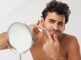 male acne treatments 