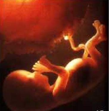 Pregnancy Week 10 11 Fetal