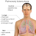 Manifestations of Pulmonary Tuberculosis (symptoms, signs) Manifestations of Pulmonary Tuberculosis (symptoms, signs)