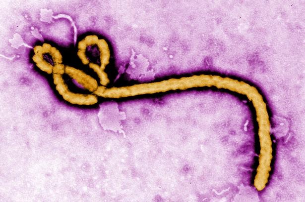 Apa Itu Ebola