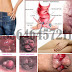 Obat Wasir dalam Bentuk Kapsul dan Salep Manjur thumbnail