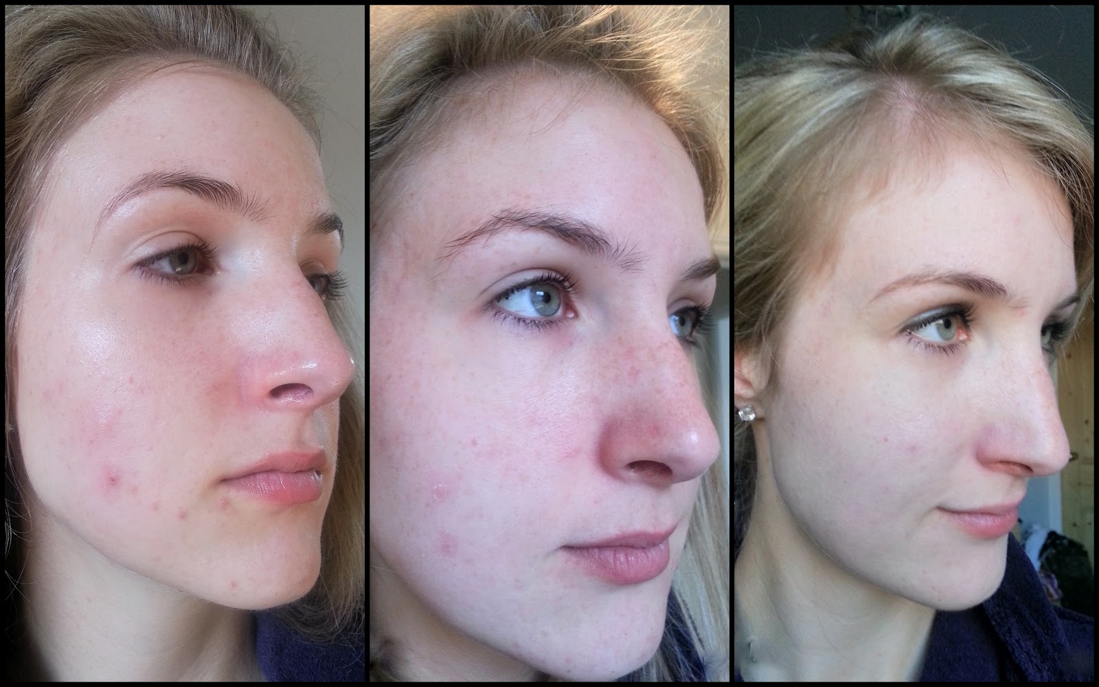 2 week no makeup challenge for better skin Lauren Loves Blog