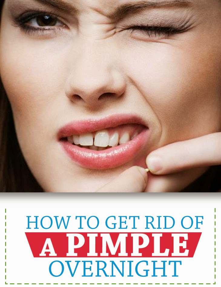 4 ways to apply toothpaste on pimples