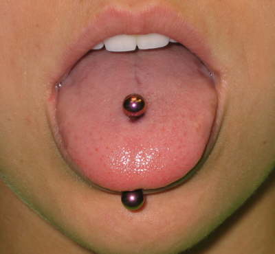 Oral piercing