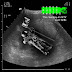 NICKI MINAJ CONFIRMS VIA SONOGRAM (!) OPENING PERFORMANCE AT THE 2015 "MTV VIDEO MUSIC AWARDS”