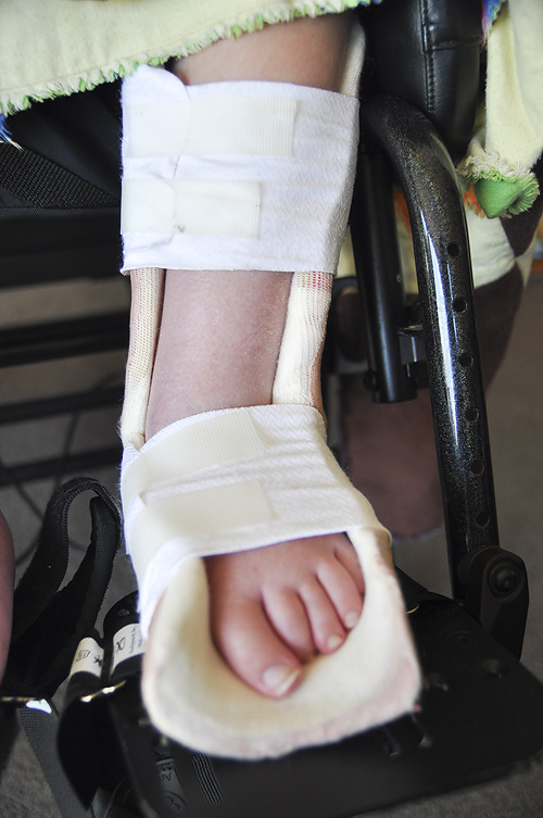 The Kings Bisphosphonate Therapy