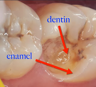 CET Enzymatic Toothpaste