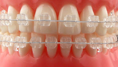 odontolog 237 a integral implantes pr 243 tesis est 233 tica dentist odontolog 237 a integral implantes pr 243 tesis est 233 tica dentist