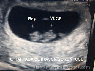 gebelikte 8. hafta resmi, hamilelikte 8. hafta fotoğrafı