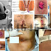 Obat Penghilang Bengkak Hemoroid (Wasir) thumbnail