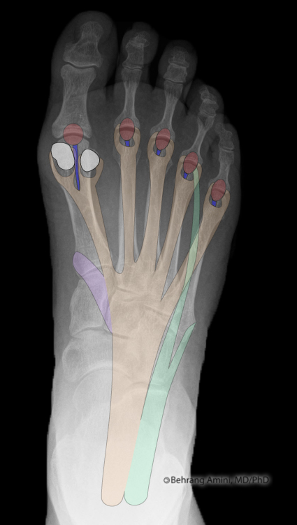 Roentgen Ray Reader: Plantar Aponeurosis: Anatomy