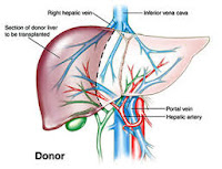 LIVER TRANSPLANTATION LIVER TRANSPLANTATION