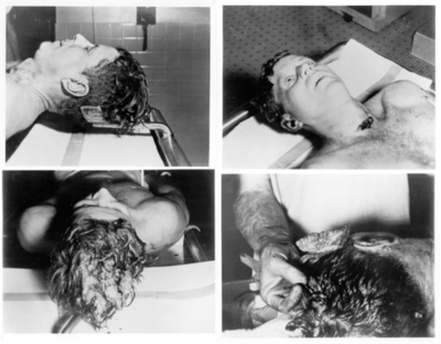 John F. Kennedy Autopsy