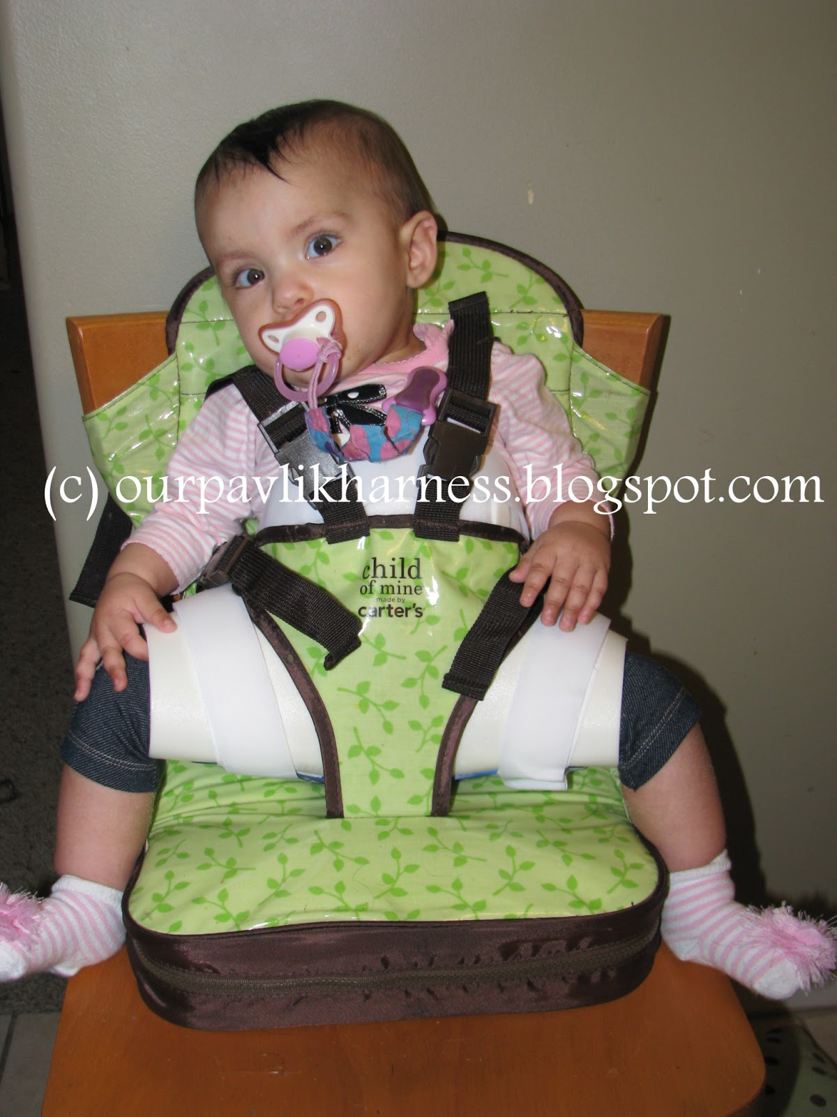 Our Pavlik Harness and journey with Hip Dysplasia Feeding
