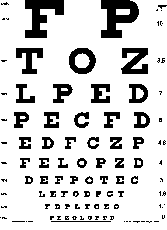 Myopia Snellen Chart