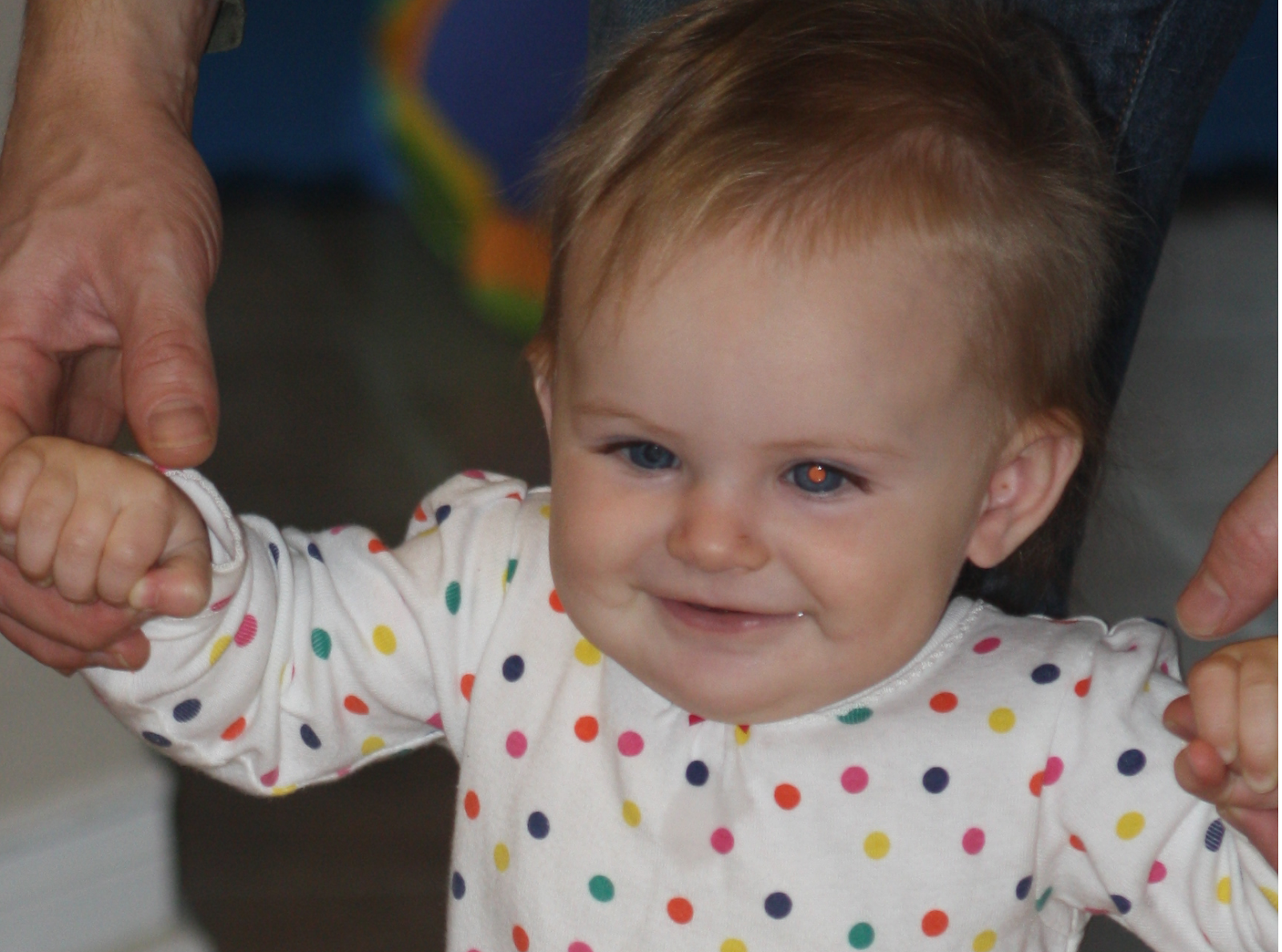 Life in the Prior Red Eye Reflex Congenital Cataract