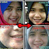 Testimoni pengguna VCO & Collagen