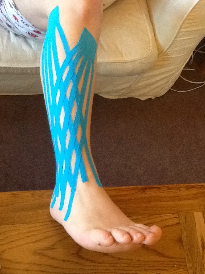 Podo Basas al Día Podología Deportiva. De nuevo con el Kinesio Tape