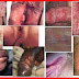 Obat ANTIBIOTIK khusus SIPILIS Apotik thumbnail