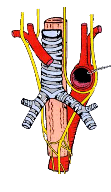 Docs Network: Regional anatomy of thorax