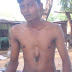 Pictured, the boy born with his heart beating OUTSIDE of his rib cage: 'Medical miracle', 18, told the slightest bump will kill him